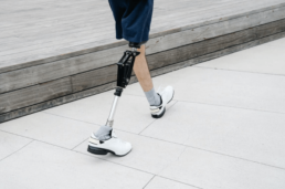 Prosthetic-Leg